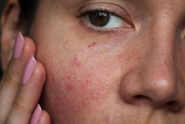 How to Build the Perfect Sensitive Skincare Routine with Youthful Balance!